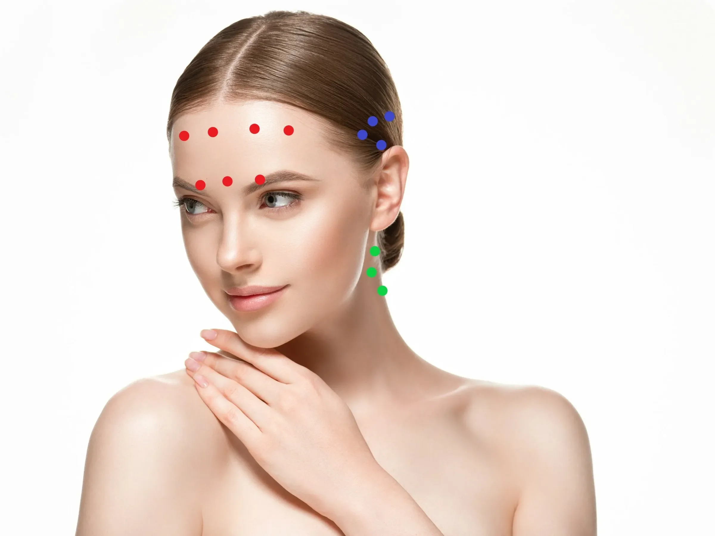Botox Hoofdpijn / Migraine bij Noveve Aesthetics