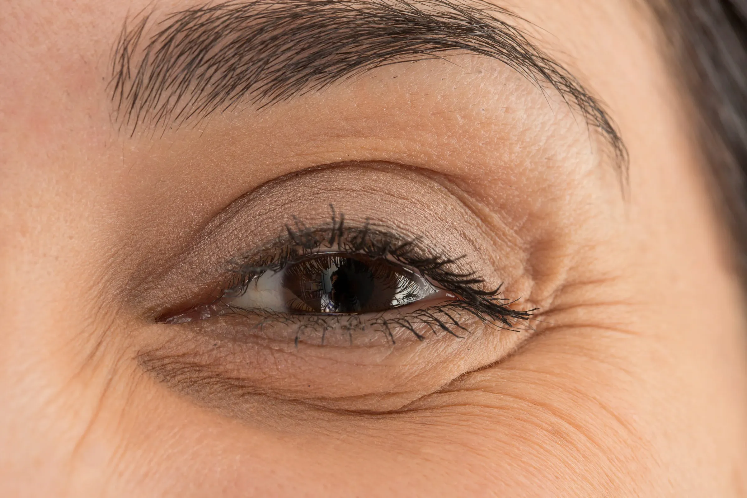 Botox Kraaienpootjes bij Noveve Aesthetics