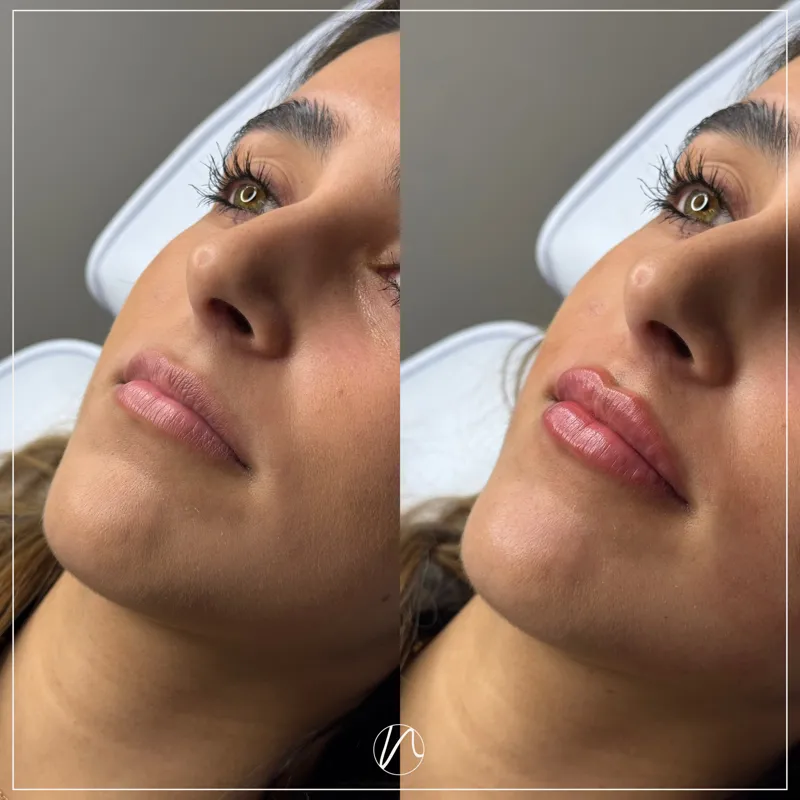 Russian Lips techniek resultaat