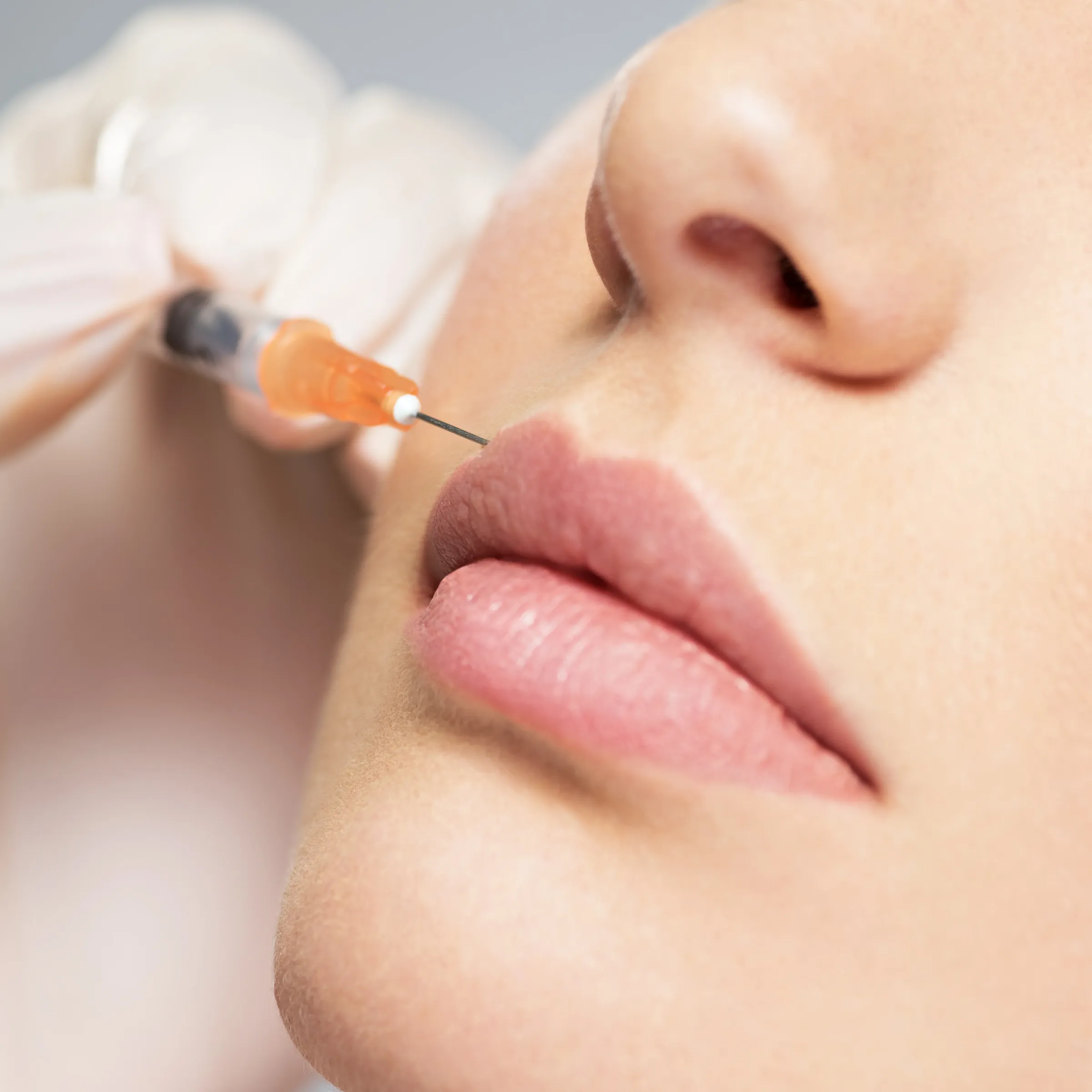 Botox Lip Flip bij Noveve Aesthetics