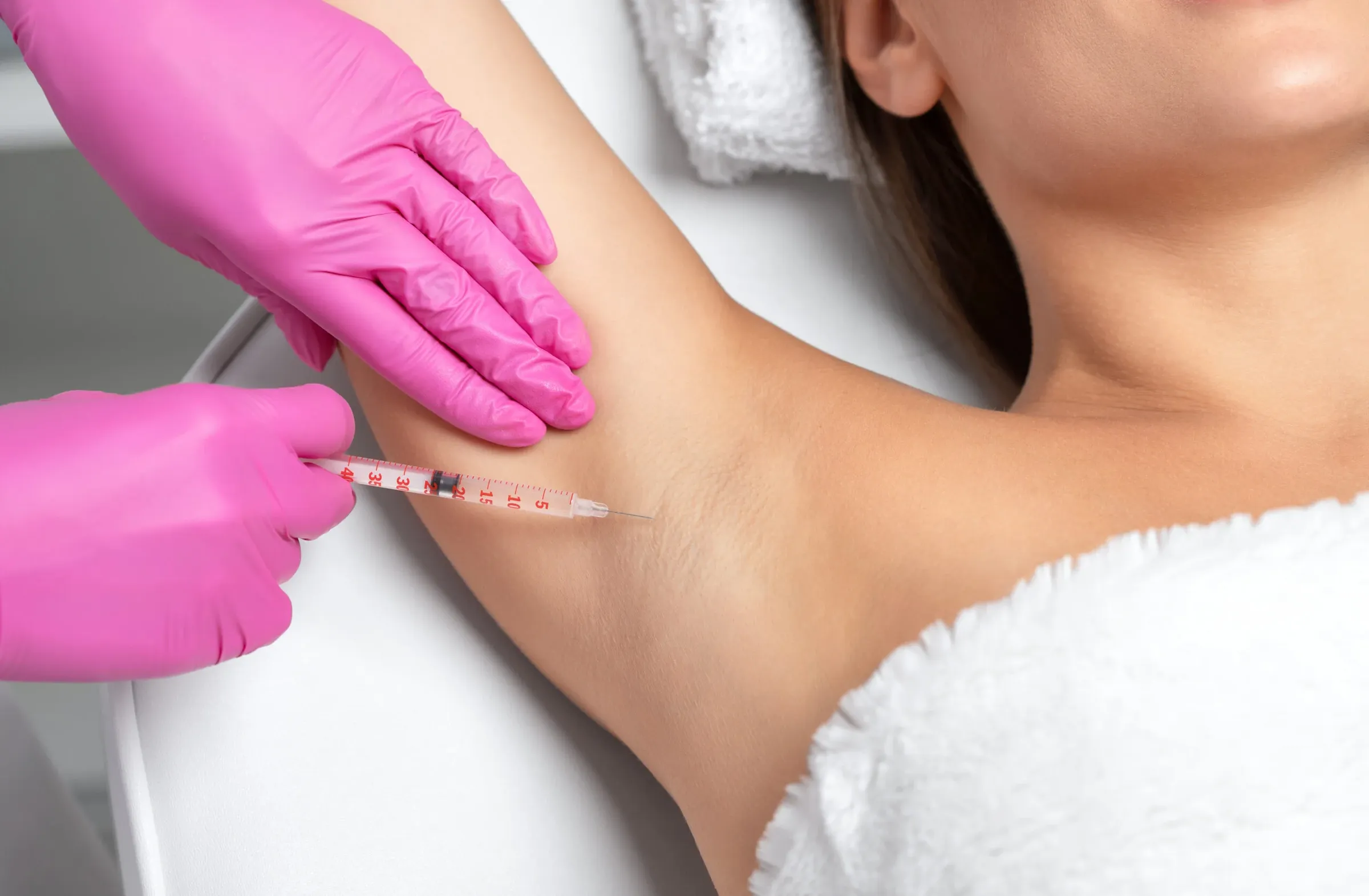 Botox Oksels (Overmatig Zweten) bij Noveve Aesthetics