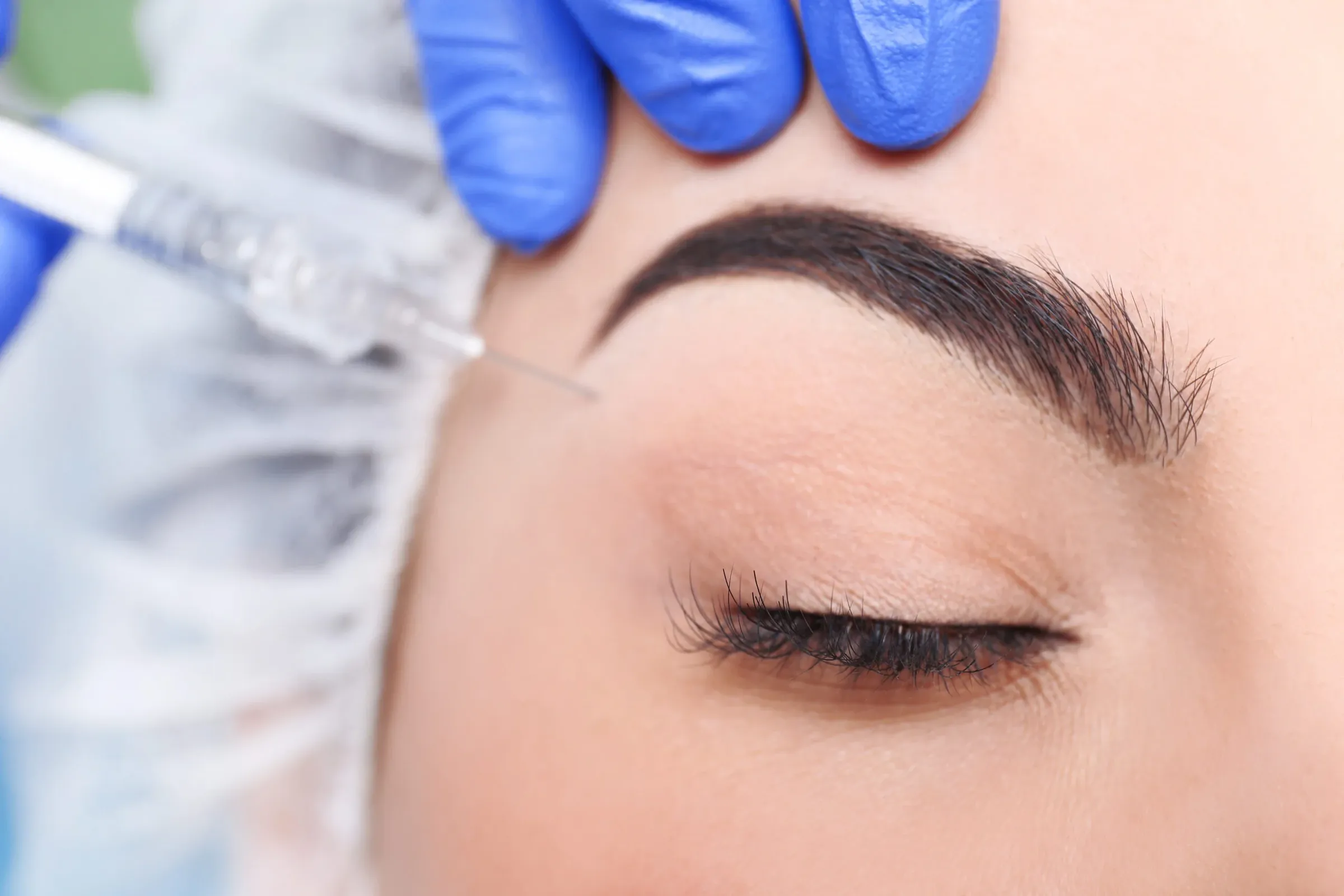 Botox Brow Lift at Noveve Aesthetics